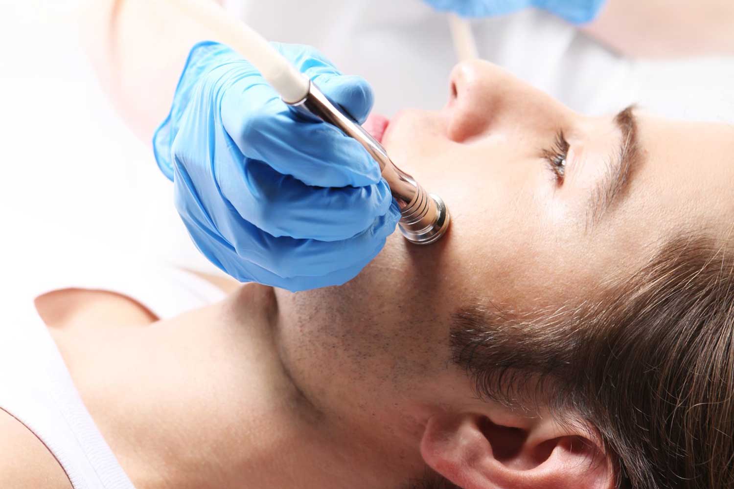 Microdermabrasion