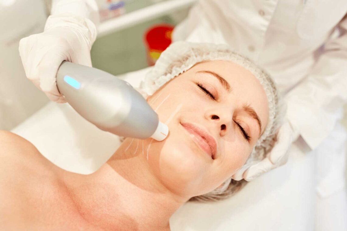 Laser Hair Removal