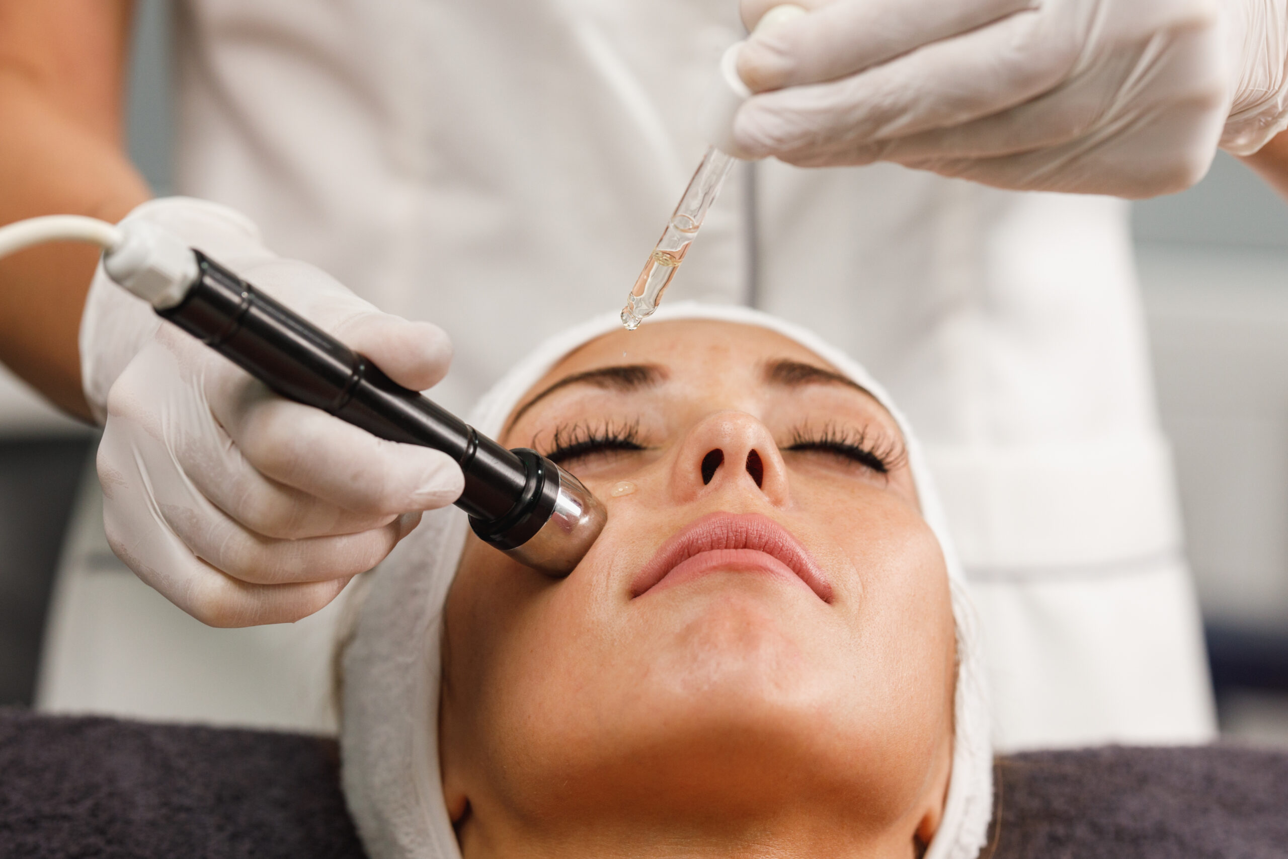 Microdermabrasion