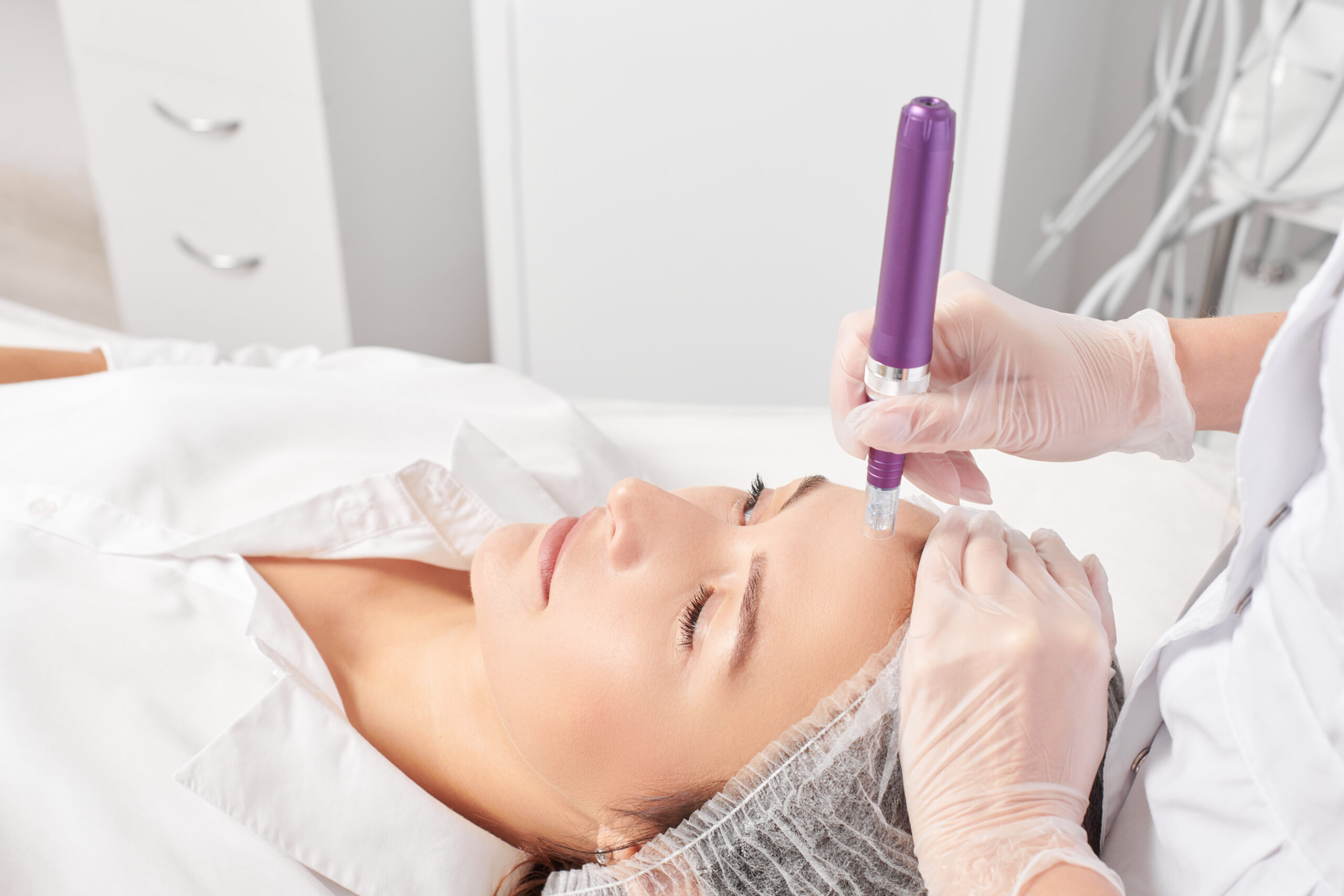 Microneedling