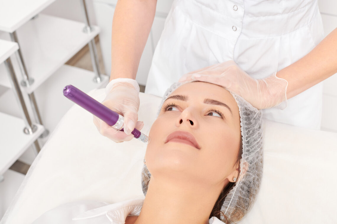 Microneedling in Newton, MA: Transform Your Skin Today