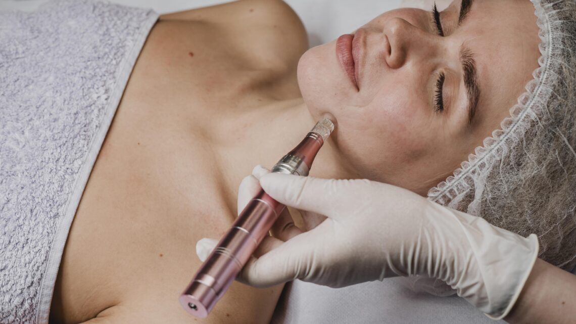 Microneedling Maintenance