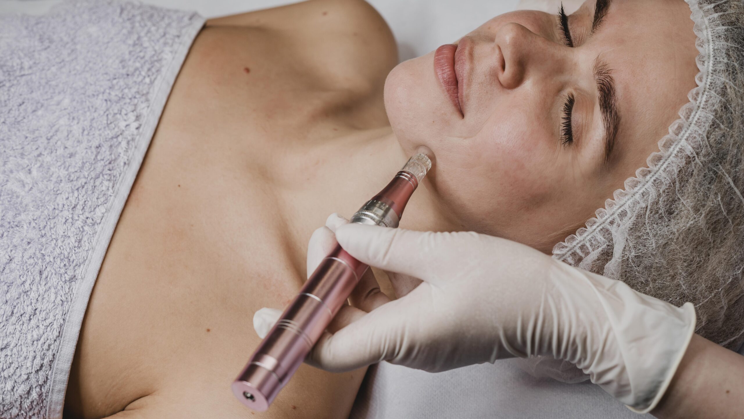 Microneedling Maintenance